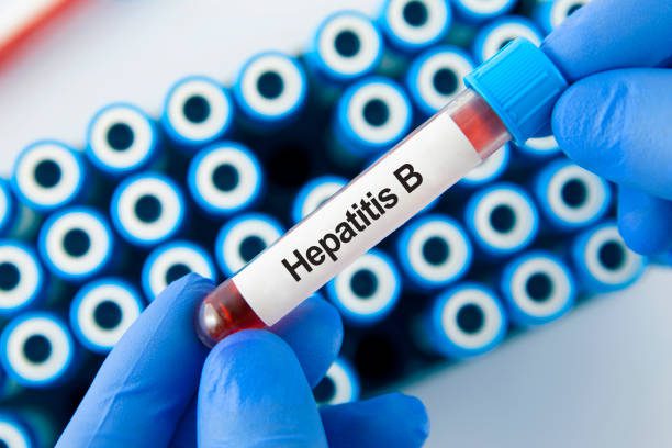diagnosis-hepatitis-b