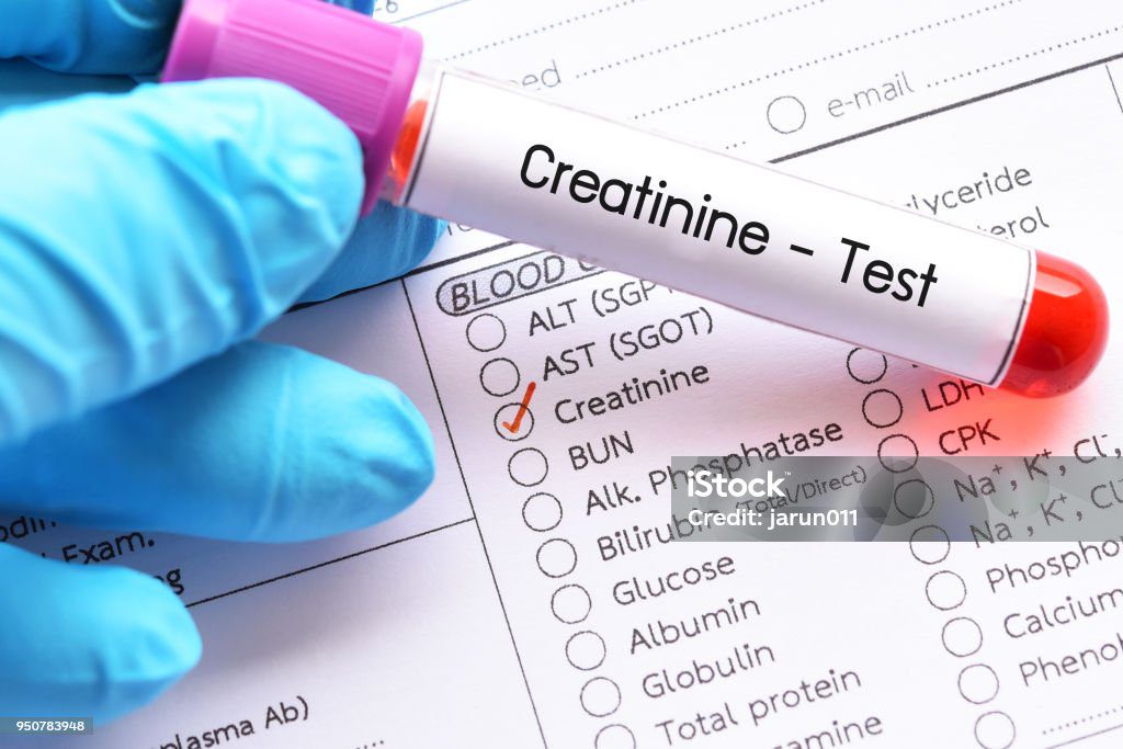 penyebab-kreatinin-tinggi-dan-renda